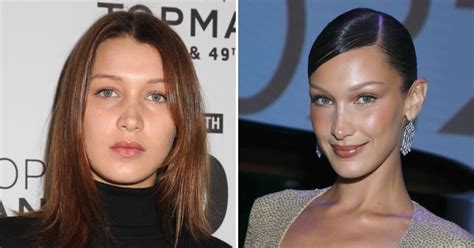 gigi hadid plastic surgery|Bella Hadid on Her Plastic Surgery History and Being。